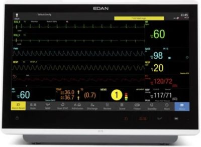 How Modern Patient Monitors Are Transforming ICU Care