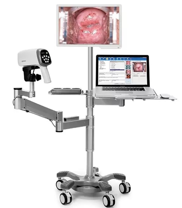 Digital Colposcope