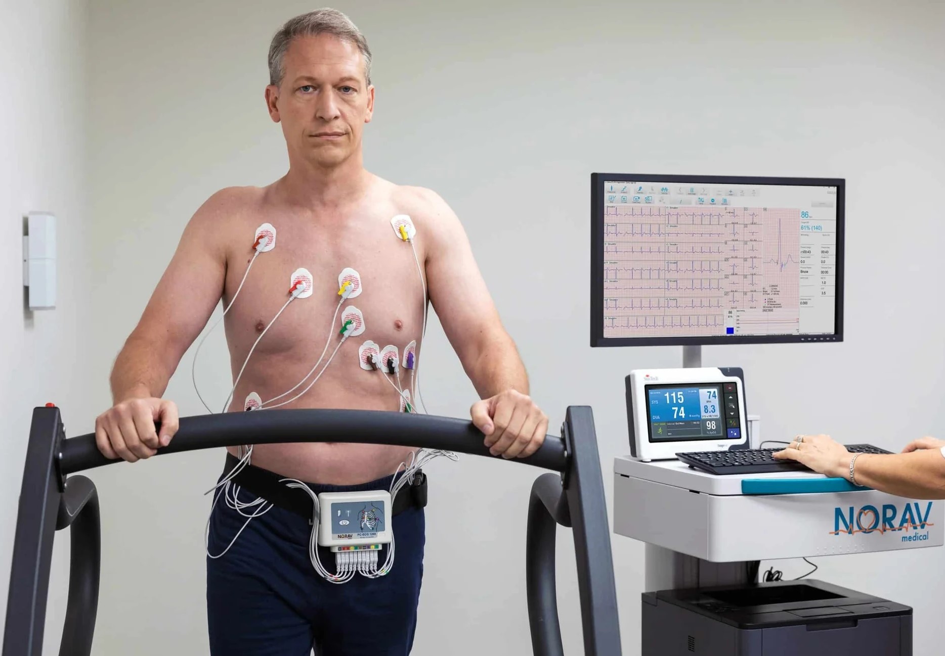Stress Test System