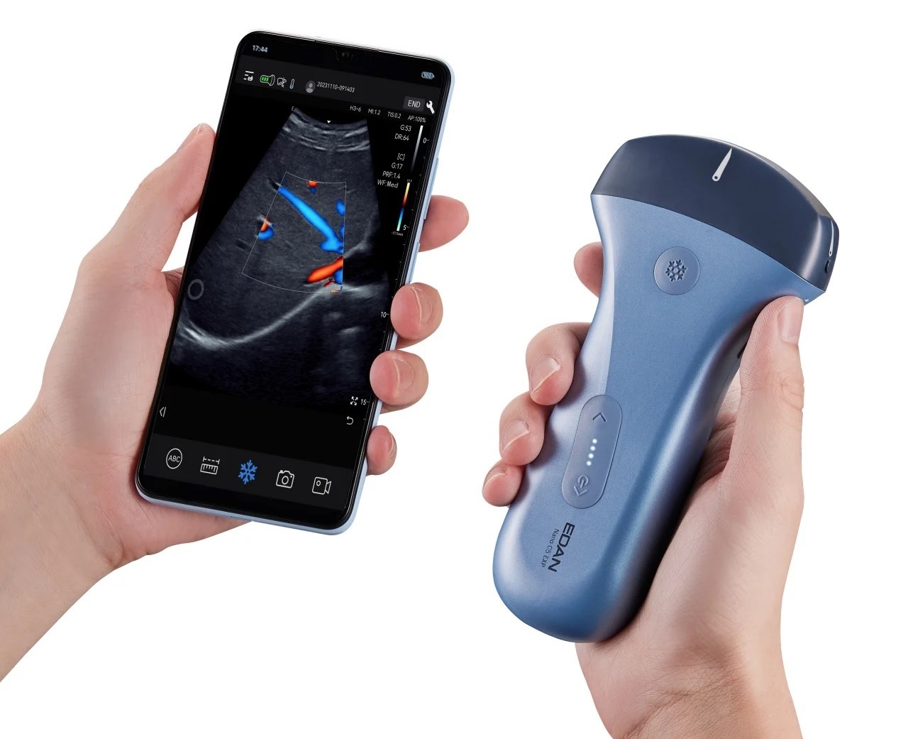 Ultrasound Pocket