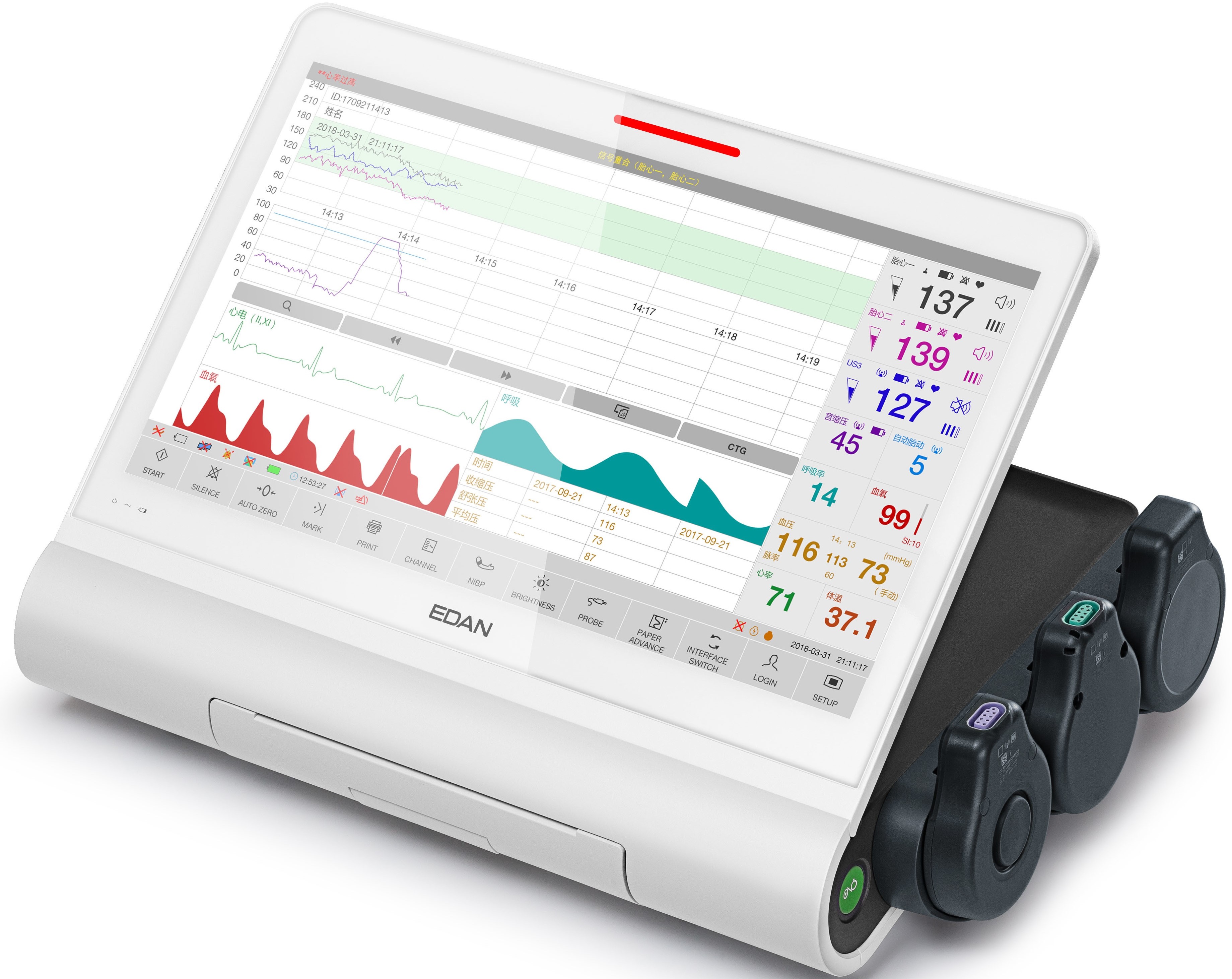 Fetal Monitor